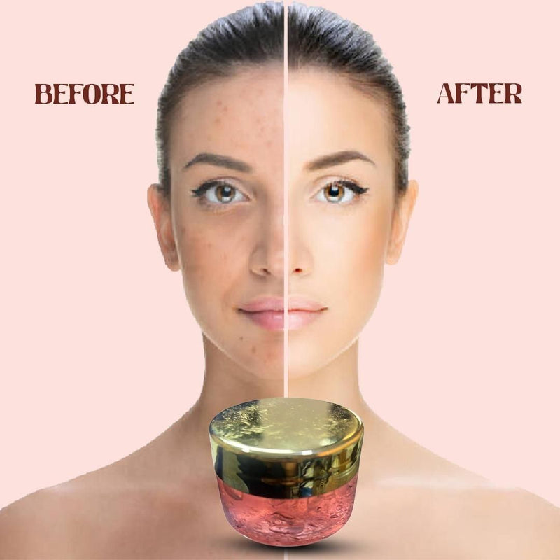 Red Aloe vera Face Gel